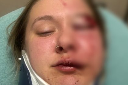 Woman just dropped off by Uber brutally beaten in random attack