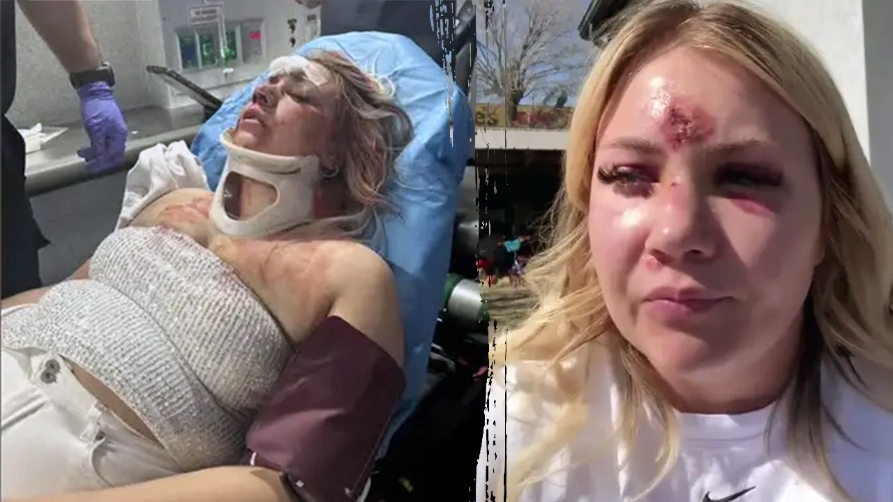 Bride-to-be left with broken nose, teeth after brutal bachelorette attack: police