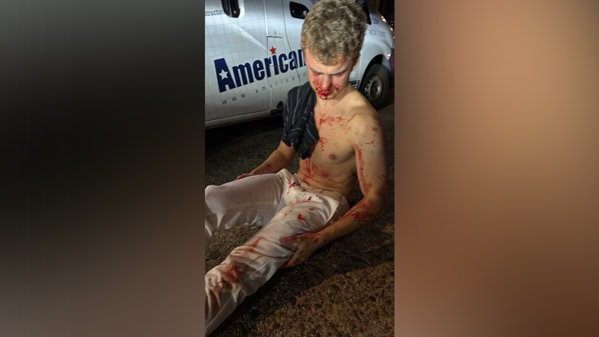 Former DOGE employee Edward "Big Balls" Coristine was attacked Monday while trying to help a woman, according to sources.