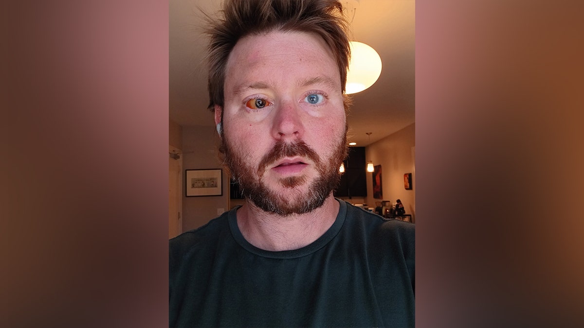 chris lewis cincinnati victim selfie with bloody eye