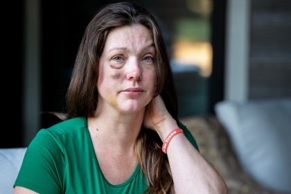 Cincinnati viral beating victim says violent mob started attacking ‘like a pack of wolves’