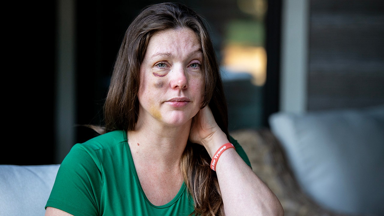 Cincinnati viral beating victim says violent mob started attacking ‘like a pack of wolves’
