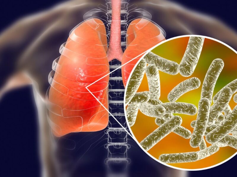 NYC Outbreak: Legionnaires’ Causes 4 Deaths