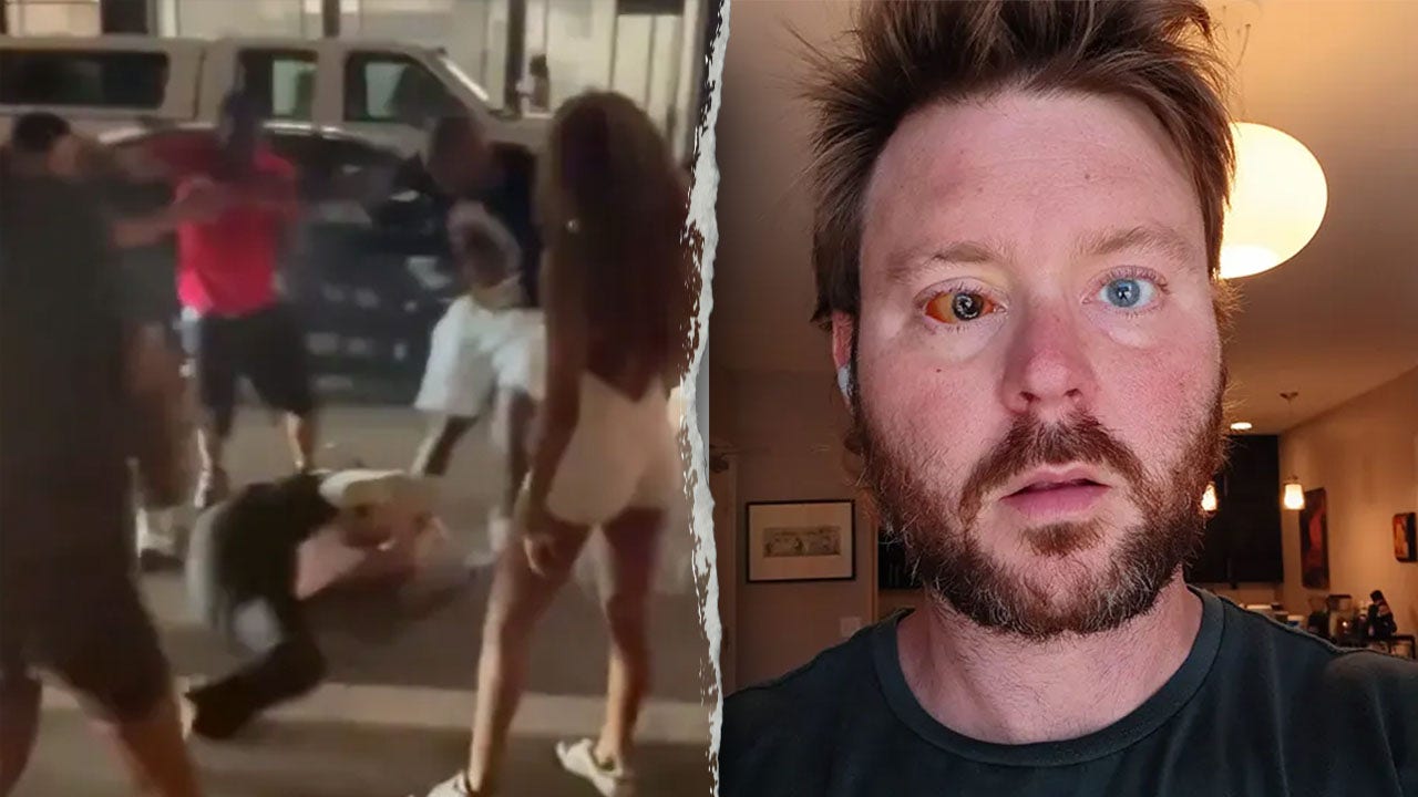 Cincinnati man who lost eye in unsolved random beating says crime ‘out of control’ after brutal viral assault