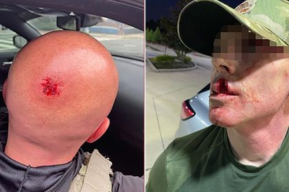 Sanctuary politicians’ rhetoric led to 1,150% surge in violence against ICE agents: DHS