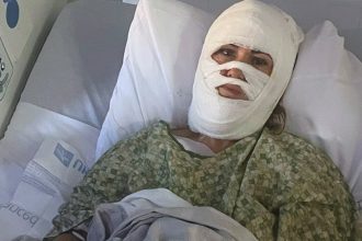 Georgia woman hospitalized after attacker hurls corrosive chemical during evening walk