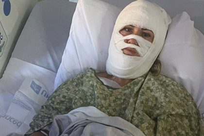 Georgia woman hospitalized after attacker hurls corrosive chemical during evening walk