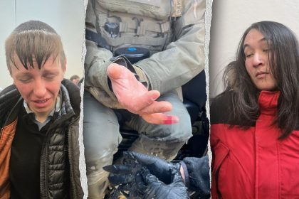 Anti-ICE agitator allegedly bites off federal officer’s finger during Minneapolis attack