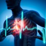 Antidepressant Use Tied to Sharp Rise in Sudden Cardiac Death Risk, Danish Study Finds