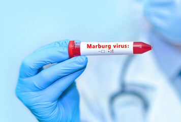 Marburg Outbreak In Uganda Threatens Ebola Containment